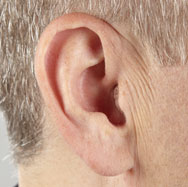 Completely-in-the-Canal (CIC) Hearing Aids